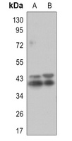 ERK1/2 (Phospho-T202/T185) Rabbit Monoclonal Antibody