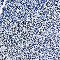 NRF2 (Phospho-S40) Rabbit Monoclonal Antibody