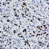 SOX9 Rabbit Monoclonal Antibody