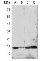 p16 ARC Rabbit Monoclonal Antibody