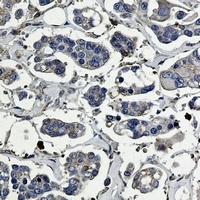 p16 ARC Rabbit Monoclonal Antibody