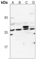 LDHA Rabbit Monoclonal Antibody