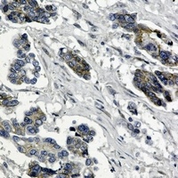 Beta-catenin Rabbit Monoclonal Antibody