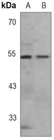 GFAP Antibody