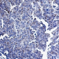 SMAD3 Rabbit Monoclonal Antibody