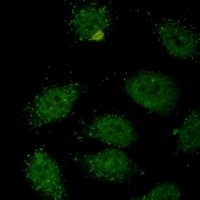 SMAD3 Rabbit Monoclonal Antibody