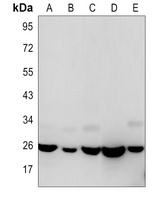 HMGB1 Rabbit Monoclonal Antibody