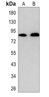 CD91 Rabbit Monoclonal Antibody