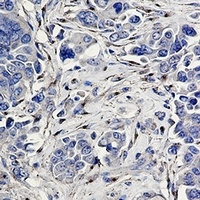 CD91 Rabbit Monoclonal Antibody