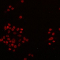 MLH1 Rabbit Monoclonal Antibody