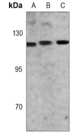 NAT10 Rabbit Monoclonal Antibody