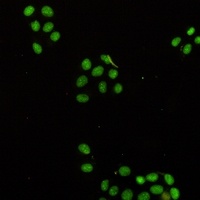 NAT10 Rabbit Monoclonal Antibody
