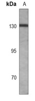 TRK B Rabbit Monoclonal Antibody