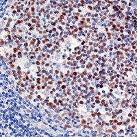 DNMT1 Rabbit Polyclonal Antibody