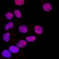 DNMT1 Rabbit Polyclonal Antibody