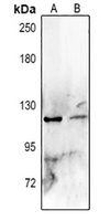 MUC2 Rabbit Polyclonal Antibody