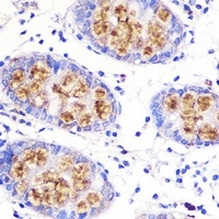 MUC2 Rabbit Polyclonal Antibody