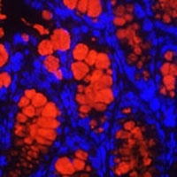 MUC2 Rabbit Polyclonal Antibody