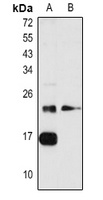 RhoA Rabbit Polyclonal Antibody