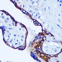 RhoA Rabbit Polyclonal Antibody