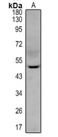 MK2 (Phospho-T334) Rabbit Polyclonal Antibody