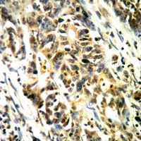 MK2 (Phospho-T334) Rabbit Polyclonal Antibody