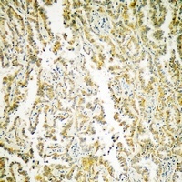 MATK Antibody