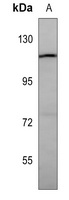 CYLD Rabbit Polyclonal Antibody