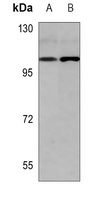 USP13 Rabbit Polyclonal Antibody
