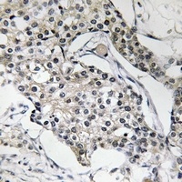 USP13 Rabbit Polyclonal Antibody
