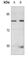 NEK4 Rabbit Polyclonal Antibody