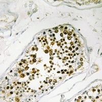 NEK4 Rabbit Polyclonal Antibody