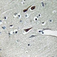 NOX5 Rabbit Polyclonal Antibody