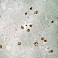 EIF5 Rabbit Polyclonal Antibody