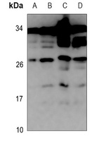 ZNRF1 Rabbit Polyclonal Antibody