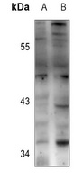 BCL2L12 Rabbit Polyclonal Antibody