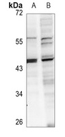ABHD12 Rabbit Polyclonal Antibody