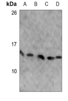 RPS25 Rabbit Polyclonal Antibody