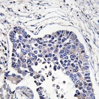 AIFM2 Antibody