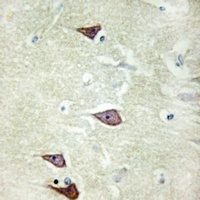 Collagen 25 alpha 1 Antibody