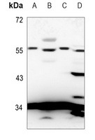 5-HT5A Rabbit Polyclonal Antibody