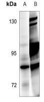 BRSK1 Rabbit Polyclonal Antibody