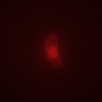 BRSK1 Rabbit Polyclonal Antibody