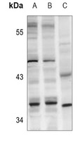 CTU1 Rabbit Polyclonal Antibody