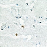 Shugoshin 1 Rabbit Polyclonal Antibody