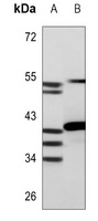 HOXA1/B1/D1 Rabbit Polyclonal Antibody