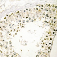 HOXA1/B1/D1 Rabbit Polyclonal Antibody