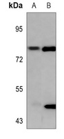 PKC gamma (Phospho-T655) Rabbit Polyclonal Antibody
