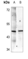 SGK1 (Phospho-T256) Rabbit Polyclonal Antibody