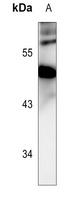 PRAK (Phospho-T182) Rabbit Polyclonal Antibody